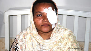 Fehmida Bibi, 38 years old, from Pakistan, a victim of preventable blindness